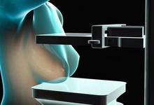 Científicos de Unicen y Conicet diseñan mamógrafo sin rayos X